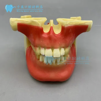 Стоматологическая модель, студенческая практика, имплантация зубов, модель для поддержки ногтей, модель для имитации пены, модель кости